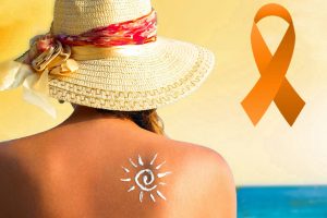 sc supera norte e nordeste em casos de cancer de pele e chegada do verao acende alerta laarana