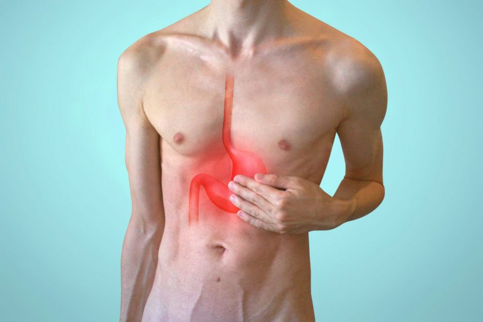 dieta para gastrite e refluxo stomachache g10615071d 1920