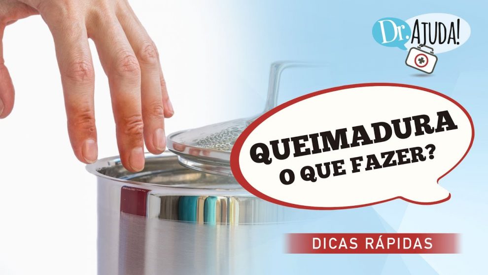 queimadura o que fazer e o que nao fazer maxresdefault