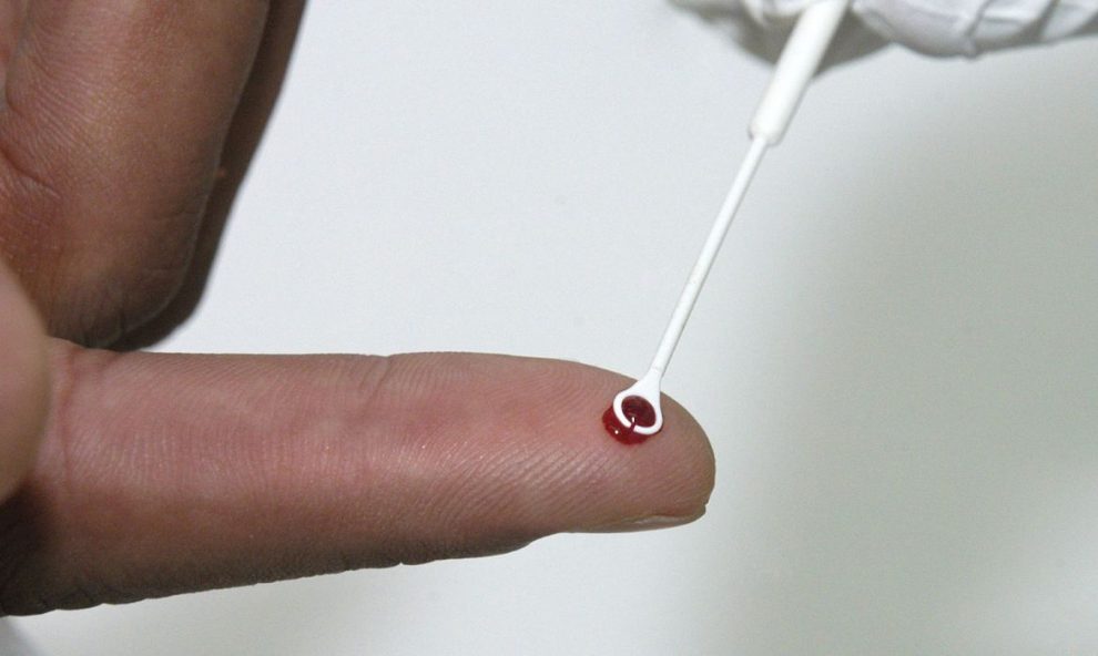 medicamento injetavel e nova opcao de prevencao contra hiv no brasil fiocruz 20061005 vinicius marinho 00498