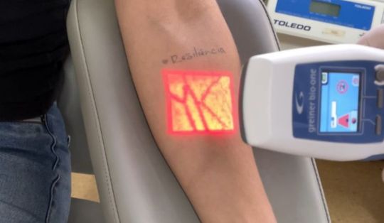 hemosc inova com sistema de visualizacao de veias para qualificar atendimento aos pacientes 12 1