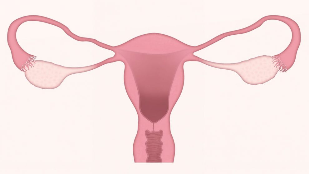 cancer do colo de utero pode ser prevenido com vacina e exame disponiveis no sus utero por ljnovascotia via pixabay