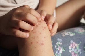 enchentes no rs contaminacao de agua e alimentos aumentam os riscos da populacao contrair enterovirus unnamed 23
