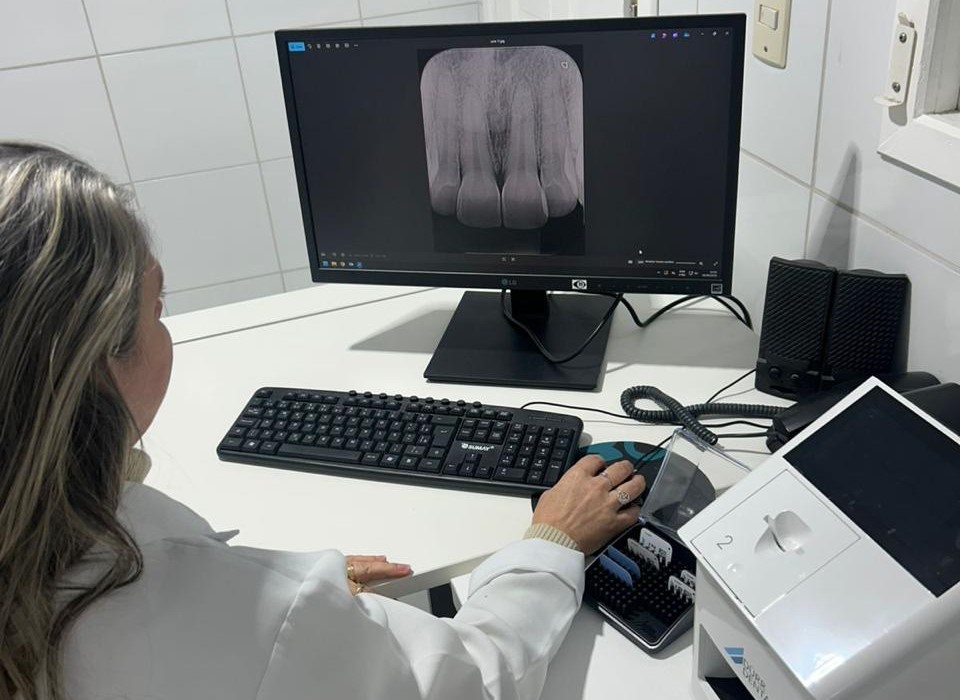 cocal do sul moderniza radiologia odontologica e reduz tempo de espera dos pacientes em ate uma semana raio x cocal do sul