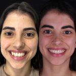 alinhadores invisiveis unem estetica conforto e tecnologia para transformar sorrisos whatsapp image 2026 08 25 at 19.01.14